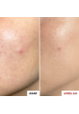 Гель з ефектом патч Erborian Centella SOS Patch 9mL