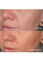 Сироватка для корекції пігментації HydroPeptide LumaPro-C 30 mL