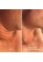 Ліфтинг-сироватка для шиї та декольте HydroPeptide Firm-A-Fix Nectar 50 mL