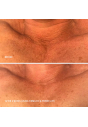 Ліфтинг-сироватка для шиї та декольте HydroPeptide Firm-A-Fix Nectar 50 mL