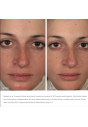 Заспокоююча гель-маска Image Skincare Ormedic Balancing Gel Masque