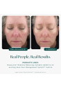 Лосьйон для шкіри Jan Marini Rosalieve Redness Reducing Complex 30mL